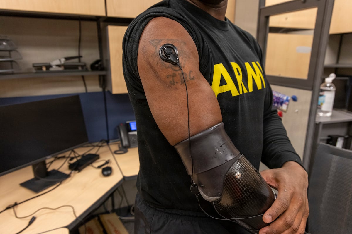 Soldier regains sense of touch through neural-enabled prosthetic limb